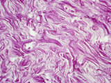 Collagen, a Fibrous Protein, in Human Skin