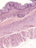Cross-Section of the Esophagus Wall