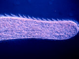 Spirostomum Protozoa Showing Metachrony of its Cilia That are Used in Locomotion