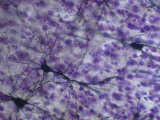 Purkinje Cells of the Cerebellum of the Brain. X60