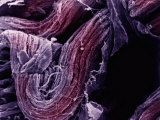 Mammal Nerve, Showing the Ventral Nerve Root Near the Spinal Cord