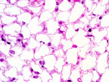 Human White Adipose Tissue or White Fat Tissue, H&E Stain