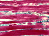 Striated or Skeletal Muscle, Longitudinal Section
