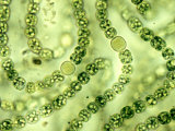 Nostoc Cyanobacteria, with Heterocysts Important in Nitrogen Fixation