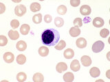 Normal Human Lymphocyte and Red Blood Cells in Peripheral Blood, Wright Stain