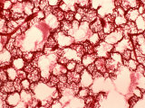Buy Normal Lung Alveoli and Surrounding Capillaries, the Sites of Gas Exchange at AllPosters.com