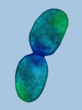 Buy Dividing Pseudomonas Aeruginosa Bacteria. Tem, Negative Stain at AllPosters.com