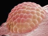 Ant Eye, Boston Museum of Science