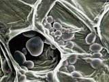 Starch Grains in Plant Cells