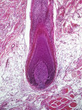 Human Hair Follicle, Vertical Section Showing Root of Hair. H&E Stain
