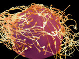 Human Sperm Fertilizing an Egg