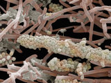 Dental Plaque and Oral Microorganisms