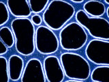 Yeast Among Gas Bubbles (Saccharomyces Cerevisiae). Darkfield