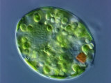 Trachelomonas Euglenoid Algae Showing its Chloroplasts, Rigid Lorica, and Eyespot
