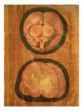 Anatomical Drawing of the Human Brain