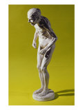 Buy Figure of a Woman with Parkinson's Disease at AllPosters.com