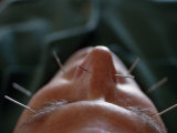 Buy Acupuncture at AllPosters.com