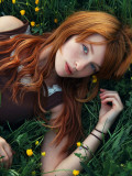 Freckles