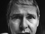 Eyes of Photographer Margaret Bourke White, Who Suffers from Parkinson