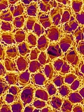 Blood Vessel Cast from Stomach of a Rat