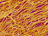 Blood Vessel Cast in Heart of a Rat