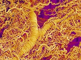 Blood Vessel Cast in Connective Tissue of a Rat