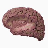 Human Cerebrum with Section Removed