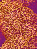 Blood Vessel Cast from Rat Colon