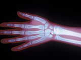 X-ray of a Child's Hand