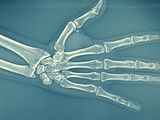 Buy Bones of Normal Human Hand at AllPosters.com