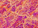 Blood Vessel Cast of Connective Tissue of a Rat