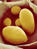 Starch Grains of Potato Cells