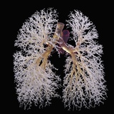 Resin Cast of Lung Bronchi