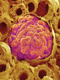 Glomerulus from Rat Kidney
