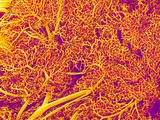 Blood Vessel Cast from Rat Pancreas