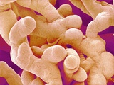 Buy Human Placenta at AllPosters.com