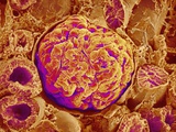 Buy Glomerulus of kidney at AllPosters.com