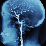 X-Ray of Human Head