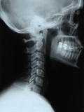 Buy X-Ray of a Human Head at AllPosters.com