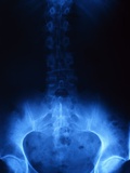 Buy X-Ray of Human Lower Spine at AllPosters.com