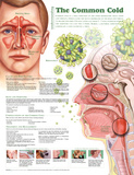 Buy Understanding the Common Cold Anatomical Chart 2nd Edition Poster Print at AllPosters.com