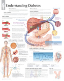 Understanding Diabetes Educational Chart Poster