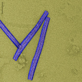 Negatively-Stained (Uranyl Acetate) Tobacco Mosaic Virus (TMV), TEM Photographic Print