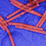Negatively-Stained (Uranyl Acetate) Tobacco Mosaic Virus (TMV), TEM Photographic Print