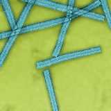 Negatively-Stained (Uranyl Acetate) Tobacco Mosaic Virus (TMV), TEM Photographic Print