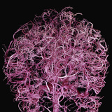 Partial Arterial Cast of Human Brain