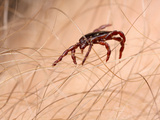 American Dog Tick (Dermacentor Variabilis)