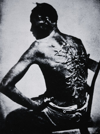 The Scarred Back of a Male Slave c1855 Photographic Print