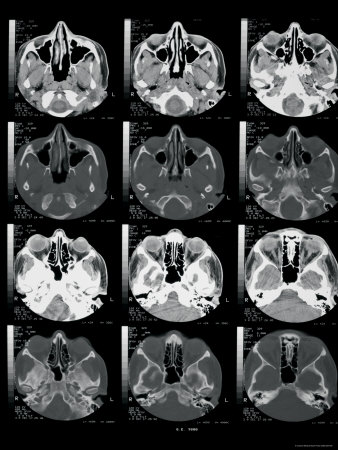 Ct+scan+brain+anatomy