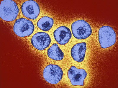 common cold virus. Common Cold Virus common